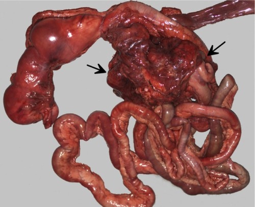 Figure 2 Gross necropsy photograph of intestinal tract with large cryptococcal lesion (demarcated by arrows) adhered to the root of the mesentery.