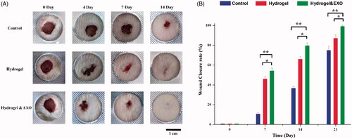 Figure 6. Hydrogel and EXOs facilitated wound closure rate in 14 days. (A) Representative images of healing process in wounds treated with saline, pure hydrogel and hydrogel and EXOs. (B) Wound closure rates of all three groups.