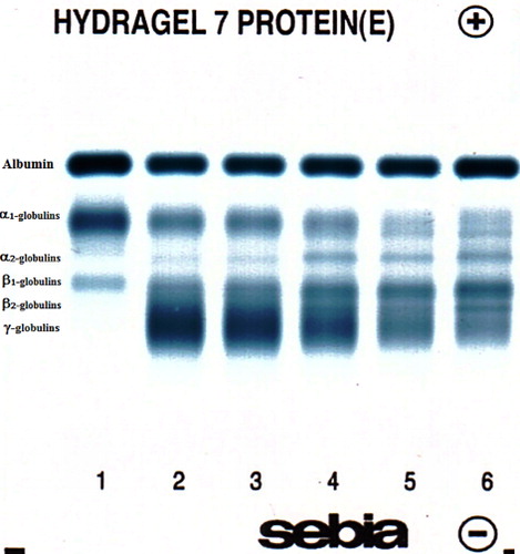 Figure 2. Electrophoretic separation of serum proteins using agarose gel electrophoresis in a calf during the first month of life: (1) precolostral serum – day 0, (2) day 1, (3) day 2, (4) day 7, (5) day 14 and (6) day 30.