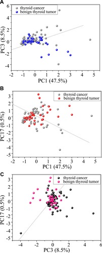 Figure 2 Scatter plot of PCA in the benign thyroid tumor group and the thyroid cancer group. (A) PC1 vs PC3; (B) PC1 vs C17; (C) PC3 vs PC17 as X, Y axes. Diagnostic line (−0.10889 = −0.49PC1 + 0.887PC3; 0.085 = 0.617PC1 + 0.8PC17; −0.12 = 0.829PC3 - 0.594PC17). The diagnostic sensitivity of benign thyroid tumor and thyroid cancer samples was 84.3%, 64.3%, 61.4% and the specificity were 43.8%, 43.8%, and 53.1%, respectively.