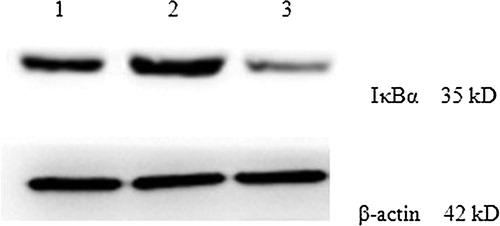 Figure 6. IκB expression levels in KM3 cells under various culture conditions as assessed by western blot. (1) The KM3 group 2: The KM3/hUCBDSC co-culture group 3: The KM3/MM-BMSC co-culture group. After sub-culture for 4 days, KM3 cells from each of the three groups were collected, and the expression levels of IκB were examined by Western blot. The IκB expression levels in KM3 cells from the KM3/hUCBDSC group were increased compared with the KM3/MM-BMSC group. Each experiment was performed three times. hUCBDSCs, human umbilical cord blood-derived stromal cells; MM-BMSCs, multiple myeloma bone marrow stromal cells; IκB, inhibitor kappa B.
