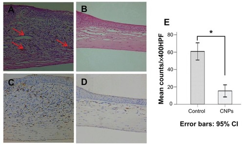 Figure 6 Celastrol nanoparticles inhibit neovascularization and macrophage infiltration in rat cornea. Rats were treated with celastrol nanoparticles (0.544 mg per rat) on day 0 and day 3 after surgery. Corneal tissue was fixed in 10% neutralized buffered formaldehyde, and 5 μm paraffin sections were stained with hematoxylin and eosin. (A) Celastrol nanoparticle-treated group showed significantly inhibited neovascularization and inflammatory cell infiltration in cornea on day 6 after surgery when compared with (B) the control group. Red arrows show new blood vessels. Corneal sections were processed by anti-rat CD68 staining in (C) celastrol nanoparticle-treated group and (D) the control group. Celastrol nanoparticles suppressed macrophage infiltration in the cornea on day 6 after surgery. The number of infiltrated macrophage (CD68+) cells in the corneal stroma was counted in five randomly selected fields (×400) of the immunofluorescence-stained slides.Notes: The number of infiltrating macrophages was analyzed by IBM SPSS (v 16.0; SPSS Inc, Chicago, IL). The data are presented as mean ± standard deviation (magnification: ×100). Statistical significance is based on the difference when compared with the control; *P < 0.001.Abbreviation: CI, confidence interval.