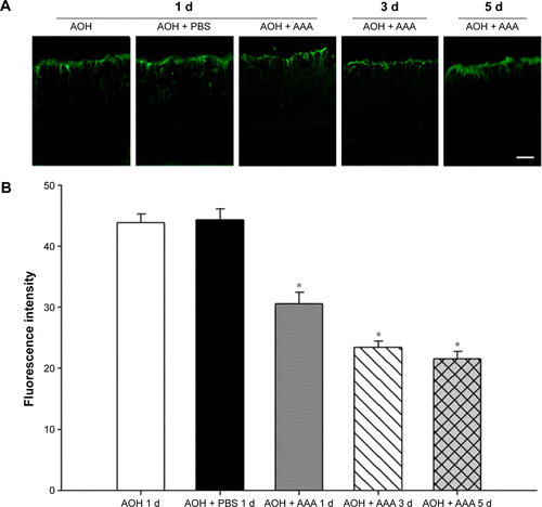 Figure S3 Increased GFAP immunoreactivity after AOH induction in rat retinas.