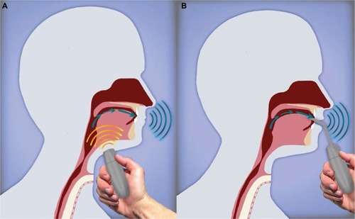 Figure 2 Electrolarynx.