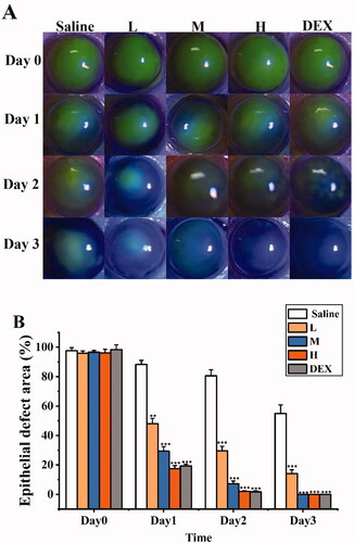 Figure 11. SRB promoted corneal epithelial recovery after treatment. (a) Representative images of the mice corneas with fluorescein staining. (b) The area of epithelial defect. (L: 0.0125% SRB-NLC, M: 0.025% SRB-NLC, H: 0.05% SRB-NLC) (*P < 0.05, **P < 0.01, ***P < 0.001 vs saline).