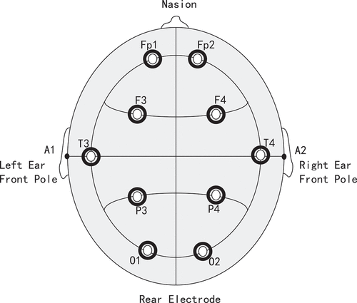 Figure 2. Electrodes setting