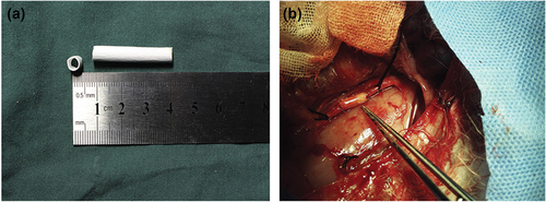 Figure 5. ePTFE electrospun vascular graft loaded with heparin and VEGF (a). Vascular graft implantation in the intrarenal aorta of a rabbit model (b). Reproduced with permission from Y.-T. Hu et al. [Citation110].