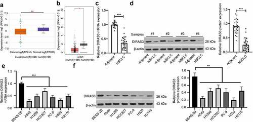 Figure 1. DIRAS3 is lowly expressed in NSCLC cells. A-B. DIRAS3 expression in lung adenocarcinoma (a) and lung squamous cell carcinoma (b) through online database. C-D. The mRNA and protein expression of DIRAS3 in NSCLC tissues were determined RT-qPCR (c) and Western blot assay (d) (n = 25). E-F. The mRNA expression of DIRAS3 in NSCLC cell lines (A549, H1299, HCC827, PC-9, H520 and H2170) and normal lung epithelial cell line BEAS-2B were determined RT-qPCR (e) and Western blot assay (f). *P < 0.05, **P< 0.01, ***P < 0.001. The experiment was repeated three times and the data were expressed as mean ± standard deviation. Paired t-test, One-way ANOVA and Tukey’s post hoc test were used for analysis.