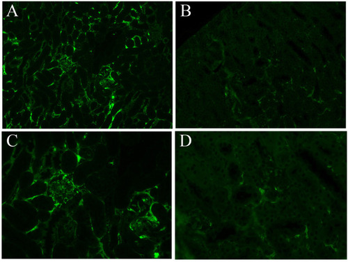 Figure 2 Analysis of renal immunofluorescence changes in the two groups. Panel (A) (100×) and panel (C) (400×) show the control group, panel (B) (100×) and panel (D) (400×) show the experimental group. The immunofluorescence of the experimental group was weaker than that of the control group, suggesting that the deposition of immune complexes was decreased.