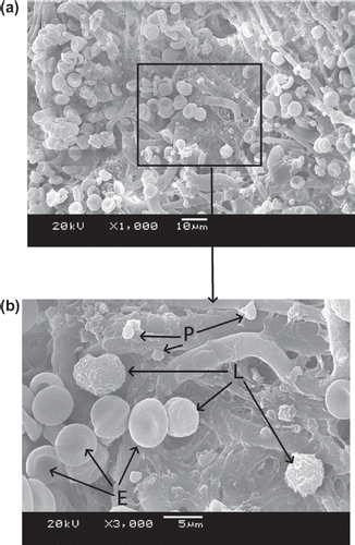 Figure 4. SEM photos of original PBTNF [erythrocytes (E), leukocytes (L), platelet (P)]; 189 × 274 mm (300 × 300 DPI).