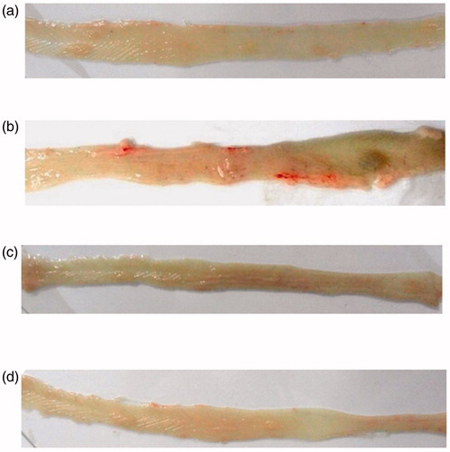 Figure 2. Comparative gross examination showing the effects of pioglitazone hydrochloride on the morphological features of the colonic mucosal surface during DMH-induced colon carcinogenesis. (a) (Group I) Normal colon of control animal, (b) (Group II): colon of DMH-treated animal, (c) (Group III): colon of DMH + Pio1-treated animal, (d) (Group IV): colon of DMH + Pio2-treated animal.