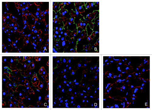 Figure 6. Immunofluorescence detection of K21 in liver. K21 in vehicle- (A) and in K21- treated monkeys after 12 (B), 24 (C), 48 (D) and 168 h (E) was detected using anti-human IgG antibody (green fluorescent detection signal). Hepatocytes were labeled with an anti-cytokeratin-8 antibody (red fluorescent signal). K21 was detected on hepatocytes up to 48 h after dosing. K21 was observed in both sinusoidal areas (single-label green fluorescence) and in hepatocytes (orange signal, corresponding to co-localization with cytokeratin-8 fluorescence). Nuclei are stained with DAPI (blue).