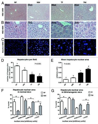 Figure 1. Histological analysis of livers from GH-overexpressing transgenic mice and normal controls. Representative photomicrographs of liver sections from normal female (NF), normal male (NM), GH-transgenic female (TF) and GH-transgenic male (TM) mice are shown. (A) H&E staining, original magnification 100×; (B) H&E staining, original magnification 400×; (C) fluorescence microscopy after Hoechst dye staining, original magnification 400×. The analysis of hepatocytes number per visual field (original magnification 400×) is displayed in (D). The analysis of the hepatocyte nuclear area is displayed in (E) mean hepatocyte nuclear area; (F and G) hepatocyte nuclear area size distribution for normal and GH-transgenice mice, respectively. Data are the mean ± SEM of nine sets of different individuals per group. Different letters (D and E) denote significant differences. Asterisks (F and G) indicate significant differences between males and females for a same nuclear area range at p < 0.05.