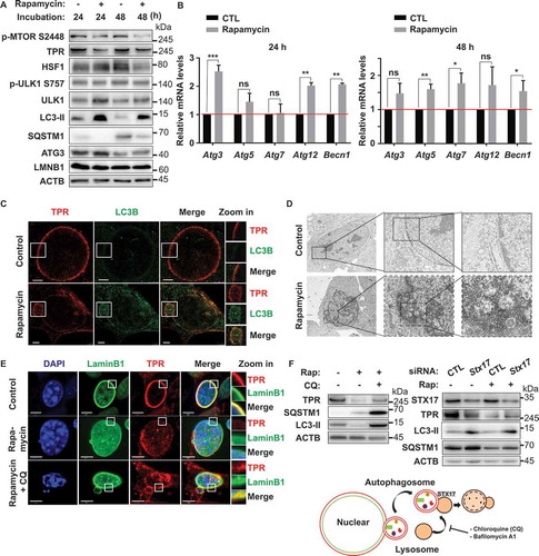 Figure 4. MTOR inhibition depleted TPR expression in vitro and induced nucleophagy. (A) Western blotting analysis of Vn19 cells treated with DMSO or rapamycin for 24 or 48 h. (B) Q-RT PCR analysis of autophagy related genes in Vn19 cells treated with DMSO or 10 nM rapamycin. Data show mean ± SD from three independent experiments (n = 3). P values are based on Student’s t-test with (***) indicating P < 0.001. (C) STED – immunostaining analysis of LC3B and TPR in Vn19 cells treated with DMSO or 10 nM rapamycin. Cell membrane blebbing were highlighted in the square (scale bar: 2.5 μm). (D) TEM analysis of Vn19 cells treated with either DMSO or 10 nM rapamycin. Autophagic vacuoles are indicated by arrows and highlighted on the right. (E) Vn19 cells treated with rapamycin or rapamycin + chloroquine (CQ) and stained with nuclear envelope protein LMNB1 and TPR. Treatment with CQ could recover TPR expression (scale bar: 5 μm). (F) Western blotting analysis of TPR, SQSTM1, and LC3B protein expression in Vn19 cells treated with CQ or siStx17 in the absence and presence of rapamycin treatment