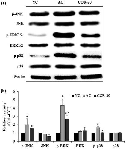 Figure 5. Effect of COR on MAPKs-mediated inflammatory signaling. (a) Protein expression of phospho-JNK, JNK, phospho-ERK1/2, ERK1/2, phospho-p38, and p38 MAPKs in YC, AC, and COR-20 groups analyzed by Western blotting in rat testis tissue; (b) Relative intensity levels (fold) in three independent experiments, respectively. β-Actin was used as an internal control. The data are expressed as the mean ± SD. #p < 0.05 compared with YC and *p < 0.05 compared with AC group. YC: young control, AC: aged control, COR-20: aged rats plus cordycepin 20 mg/kg treated group, p-JNK: phospho-c-Jun N-terminal kinase, ERK: extracellular signal-regulated kinase, p-38 MAPK: p38 mitogen-activated protein kinase.