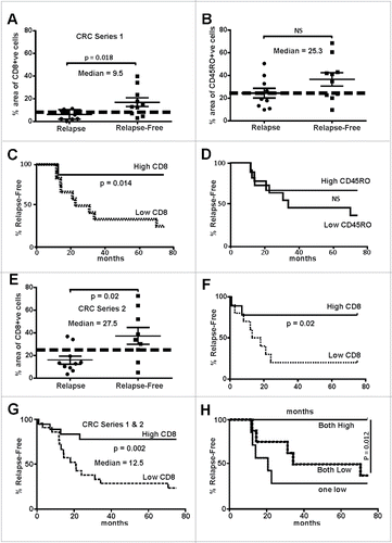 Figure 1. Abundance of tumor infiltrating lymphocytes in early stage MSS colorectal cancers track with relapse-free survival. (A) CD8+ cells were evaluated in two cohorts of patients (Series 1- RMH), one that had tumor relapse (n = 10) that other without (n = 10). The area of positive CD8+ IHC signal was found to the significantly higher in relapse-free patients (two-way t-test). (B) CD45RO+ cells IHC showed no significant difference between the two cohorts. (C) Data from (A) were used to calculate the statistical median which was used to partition with an area above 9.5% and those 9.5% and below. Relapse-free patients were found to have significantly higher CD8+ cells that tracked with relapse-free survival (Log-rank, Mantel–Cox test). (D) Data from (B) were used to calculate the median percentage of CD45RO+ cells whereby tumors with a median above 25.3% and those below were indistinguishable in terms of outcome. (E) CD8+ cells were evaluated in two cohorts of patients from a separate hospital (Series 2- SJOG), one that had tumor relapse (n = 11) that other without (n = 9). The area of positive CD8+ IHC signal was found to the significantly higher in relapse-free patients (two-way t-test, n = 10). (F) Data from (E) were used to calculate the statistical median which was used to partition with an area above 27.5% and those below whereby the relapse-free patients were found to have significantly higher CD8+ cells tracked with relapse-free survival (Log-rank, Mantel–Cox test). (G) Data from Series 1 and 2 (Panels A and E) were pooled and the median recalculated as above and whereby tumors with a median above 12.5% and those below found to have significantly higher CD8+ cells tracked with relapse-free survival (Log-rank, Mantel–Cox test). (H) When the percentage of CD8+ plus CD45RO+ cells were evaluated those tumors where high expression was calculated patients were found to be essentially relapse-free.