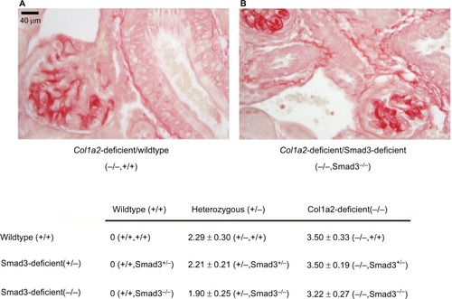 Figure 3 Col1a2-deficient/Smad3-deficient glomeruli demonstrate homotrimeric type I collagen deposition.