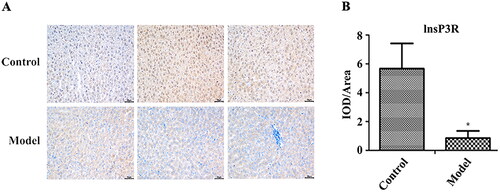 Figure 3. Immunohistochemistry analysis of InsP3R protein expression. (A) Images of immunohistochemistry. (B) Relative expression of lnsP3R protein in each group. *Expression of InsP3R in the model group was significantly lower compared with the control/normal group (p < .05).