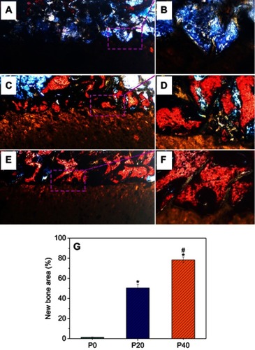 Figure 11 Van Gieson’s staining for NB growth in the samples after PK (A, B), PKLS (C, D), and PKNLS (E, F) implanted in vivo for 12 weeks. Quantitative analysis was showed in G. (*p<0.05, vs PK; #p<0.05, PKNLS vs PKLS)