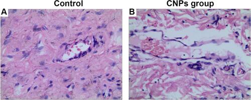 Figure 6 At 72 h after injection, H&E staining of the injection sites in the (A) 0.9% NaCl group and (B) 8 mg/mL CNPs group. (A) and (B) presented no abnormalities, such as edema, necrosis or apoptosis.