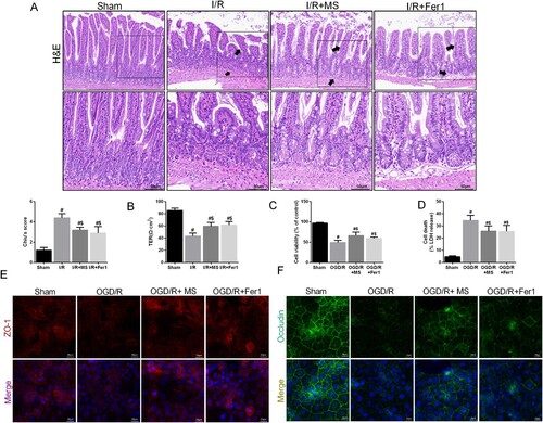 Figure 3. Methane saline alleviated intestinal I/R injury. The animal models were launched with a 60-min ischemia period as mentioned. MS (10 mL/kg) was used to treat the mice as previously mentioned (n = 10 for each group). (A) Histopathological damage was estimated with H&E staining (scale bars: 100 μm) and Chiu's score. (B) The integrity of the intestinal barrier was evaluated with TER. The OGD/R model was established in Caco-2 cells. (C) The release levels of LDH were detected. (D) Cell viability was measured with a CCK-8 assay. (E-F) The expression levels of ZO-1 and Occludin were analyzed by IF staining (Scale bars: 20 μm). The values are shown as the mean ± SD. #p < 0.05, compared with the sham group, and $p < 0.05 compared with the I/R or OGD/R group.