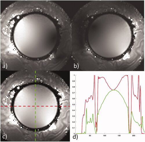Figure 4. Receive sensitivity maps of the head coil corrected for B1 in a spherical phantom for (a) channel 1, (b) channel 2, and (c) combined. The horizontal (red) and vertical (green) profiles through the combined image show a normalized signal intensity variation of 25% across the horizontal and 35% variation across the vertical center of the phantom.