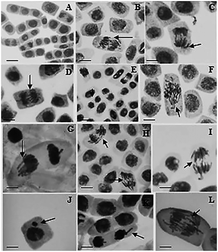 Figure 1. Cells of Allium cepa in different phases of cell division: (A) normal cells from the treatment with E. grandiflorus 6 g dm−3 (Pop. 1); (B) cell with anaphasic bridge and breakage from the treatment with E. grandiflorus 6 g dm−3 (Pop. 1); (C) cell with anaphasic bridge from the treatment with E. grandiflorus 24 g dm−3 (Pop. 1); (D) cell with anaphasic bridge from the treatment with S. montevidensis 6 g dm−3 (Pop. 1); (E) binucleate cell in interphase from the treatment with S. montevidensis 24 g dm−3 (Pop. 1); (F) cell with disorganized prophase from the treatment with E. grandiflorus 6 g dm−3 (Pop. 1); (G) cell in telophase with disorganization from the treatment of E. grandiflorus 6 g dm−3 (Pop. 2); (H) cells in anaphase with chromosomal breakages from the treatments of S. montevidensis 24 g dm−3 (Pop. 2); (I) cell in anaphase with bridge and laggard chromosomes from the treatment with S. montevidensis 24 g dm−3 (Pop. 2); (J) cell with micronucleus from the treatment with E. grandiflorus 6 g dm−3 “commercial” (Pop. 2); (K) cell in telophase with a laggard chromosome from the treatment of E. grandiflorus 6 g dm−3 “commercial” (Pop. 2); (L) cell in disorganized anaphase and chromosomal breakage from the treatment with E. grandiflorus “commercial” 24 g dm−3 (Pop. 2). Scale: 10 μm.