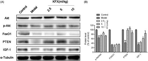 Figure 6. KFX activated IGF-1/Akt pathway in WIRS-induced ulcer rats. (A) The gastric samples were prepared with lysis buffer, resolved on 10% SDS-PAGE, and transferred to a PVDF membrane. Western blots were performed to detect the total or Akt, p-Akt, FoxO1, PTEN, IGF-1 using specific primary antibodies. (B) Densitometric analysis was used to quantify the levels of p-Akt/Akt, FoxO1, PTEN, IGF-1. The data were expressed as the means ± SD (n = 5). ##p < 0.01, compared with the control group; *p < 0.05, **p < 0.01 compared with the model group. KFX: Kangfuxin liquid.