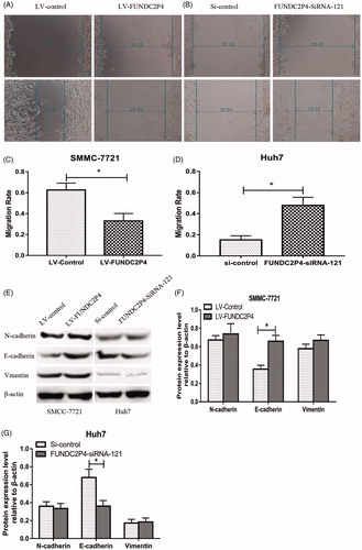 Figure 4. LncRNA FUNDC2P4 inhibits EMT by regulating E-cadherin expression. (A, B, C, D) Wound healing assays were performed in SMMC-7721 cells overexpressing LncRNA FUNDC2P4 and Huh7 cells silencing LncRNA FUNDC2P4. (E, F, G) EMT markers including E-cadherin, N-cadherin and vimentin were examined by Western blot and semi quantitative assays in SMMC-7721 cells overexpressing LncRNA FUNDC2P4 and Huh7 cells silencing LncRNA FUNDC2P4. Data shown are mean ± SD from three independent experiments. *p < 0.05.