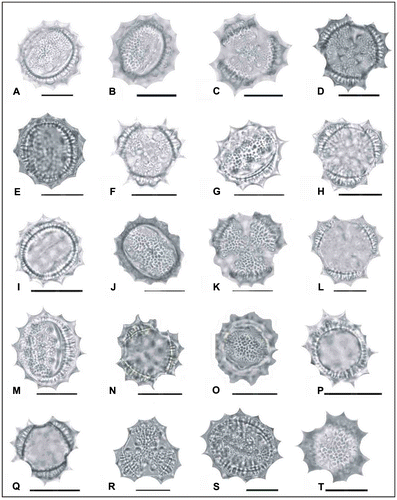 Figure 2. Light micrographs of pollen grains (×1000) Achillea cucullata (A) (from Arabacı 1949), (B, C) (from Arabacı 1763), (D, E) (from Arabacı 1884), (F, G) (from Yıldız 16832); Achillea vermicularis (H, I) (from Arabacı 1626), (J, K) (from Arabacı 1415), (L, M) (from Yıldız 15196), (N, O) (from Arabacı 2559), (P, Q) (from Yıldız 16943); Achillea monocephala (R, S) (from Arabacı 2184); Achillea schischkinii (T) (from Arabacı 1457). Scale bars 20 μm.