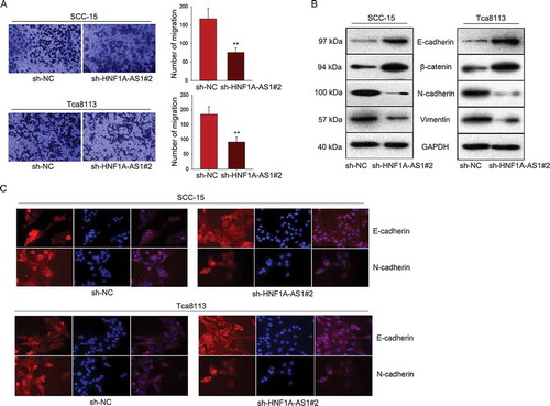 Figure 3. Knockdown of HNF1A-AS1 inhibited OSCC cell migration and epithelial-mesenchymal transition. A. Transwell assay was used to detect cell migration in OSCC cells in response to HNF1A-AS1 knockdown. B. The expression of EMT-related proteins was examined in OSCC cells transfected with sh-HNF1A-AS1. C. EMT markers were detected in indicated OSCC cells by immunofluorescence. **P < 0.01 vs. control group.