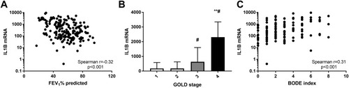Figure 5 Sputum gene expression of IL1B correlates with (A) FEV1% predicted; (B) GOLD stage and (C) BODE index. **p<0.001 versus GOLD stage 1 and GOLD stage 2; #p<0.05 versus GOLD stage 3.