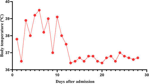 Figure 3 The curve of body temperature during hospitalization. Antifungal therapy with amphotericin B and v fluorouracil tablets was administered from day 5 after admission.