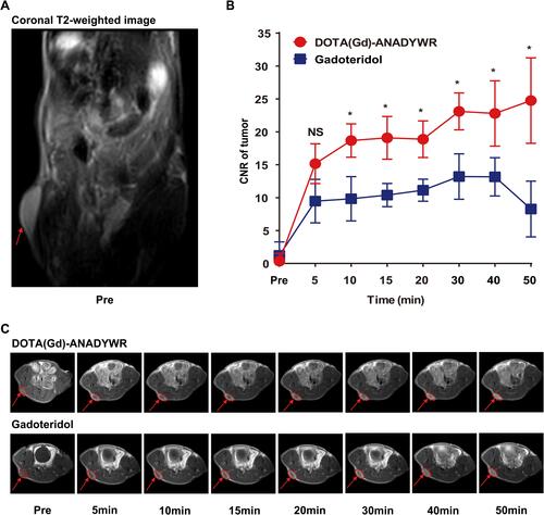 Figure 2 MR imaging with DOTA(Gd)-ANADYWR and Gadoteridol in subcutaneous HCC-LM3 tumor-bearing mice. (A) Representative coronal T2-weighted MR image before administration. The red arrowhead indicated the HCC. (B) Contrast-to-noise ratio (CNR) of tumors before and after injection of DOTA(Gd)-ANADYWR or Gadoteridol. Statistical analysis was performed using two-tailed Student’s t-test. Significance levels are given as: NS P>0.05, *P < 0.05. (C) Representative T1-weighted MR images obtained before and at different time points after intravenous administration of DOTA(Gd)-ANADYWR or Gadoteridol (The red arrowheads indicated the HCC. The red dotted circles delineated the area of interest that used for CNR analysis).