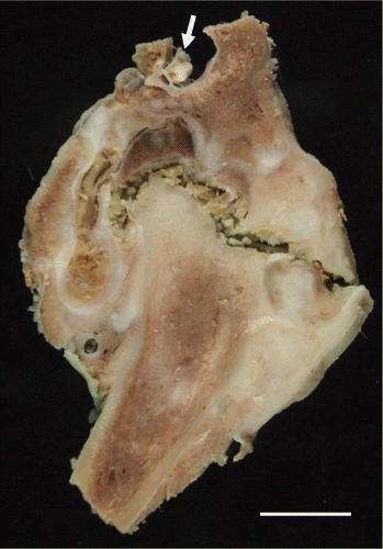 Figure 2.  Gross formalin-fixed transverse section of the left coxofemoral joint of a juvenile YEP with bilateral coxofemoral degenerative joint disease. Note the spinal cord at the top (arrow), and the femoral shaft extending down and to the left. The femoral head remnant is surrounded by necrotic debris, collagen, and organizing haemorrhage. The horizontal crack in the section is artefactual. Scale bar = 1 cm.