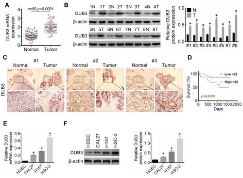 Figure 1 The production of DUB3 in OSCC tissues and cell lines. (A) DUB3 gene expression in tumor and matched paracancer tissue (normal group) were examined by qRT-PCR, p < 0.0001 vs normal group. (B and C) Then, expression of DUB3 protein in tumor and normal tissues were measured by Western blot (B) and immunohistochemistry (C). (D) The relationship between the survival rate of OSCC patients and the expression of DUB3 was analyzed, p = 0.0339 vs high group. (E) DUB3 mRNA expression in OSCC cell lines (CAL27, H157, and HSC-2) was detected using qRT-PCR. (F) Production of DUB3 protein in OSCC cell lines was discovered using Western blot. *p < 0.05 compared with the normal group or HOEC group.