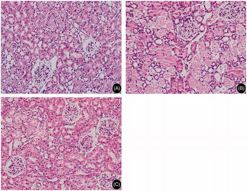 Figure 2. Histomorphological changes in rat renal tubule after renal ischemia–reperfusion injury (H&E. Magnification, ×40 in A–C). (A) sham operation group, tubular epithelial cells with normal morphology; (B) simple ischemia–reperfusion operation group, tubular epithelial cells with loss of brush border, epithelial cell necrosis and exfoliation, tubular lumen formation, basement membrane rupture and interstitial inflammatory cell infiltration and (C) Bai group, various lesions obviously alleviated in comparison to the ischemia–reperfusion operation group.