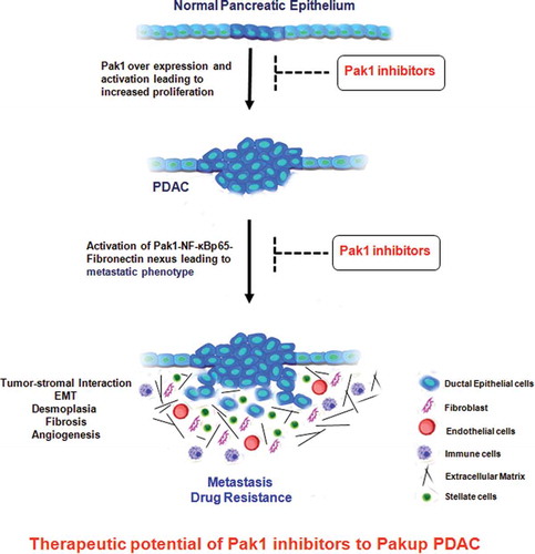 Figure 1. Pak1 over expression promotes proliferation, metastasis and drug resistance in pancreatic cancer through Pak1-NF-κBp65-Fibronectin pathway. Activation of this nexus would enhance tumorigenesis process by activating EMT, fibronectin production, fibrosis, desmoplastic reaction, increasing vascular formation and recruiting immune cells for tumor growth. Blocking of Pak1 activation and downstream nexus pathways with Pak1 inhibitors might play a therapeutic role for the treatment of pancreatic cancer.