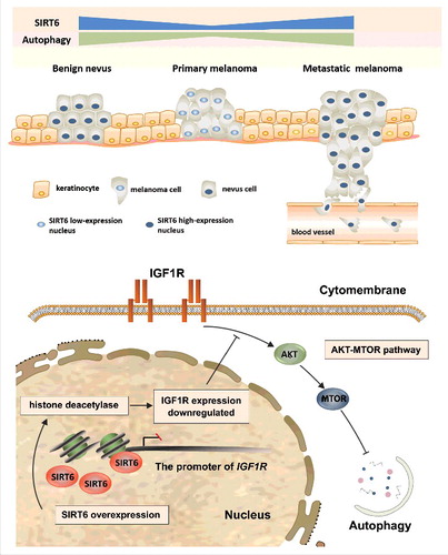 Figure 9. Schematic representation of the effects of SIRT6-regulated autophagy on melanoma growth and the underlying mechanism. In benign nevus, melanocytes undergo limited proliferation with a physiological basal level of SIRT6 and autophagy. In the case of reduced SIRT6 expression, melanocytes can proliferate uncontrollably, migrate to the upper epidermis along the basement membrane, and subsequently penetrate to the dermis, which forms primary melanoma with a lower autophagy level. Later, melanoma cells can enter into blood vessels and develop distant metastases, with SIRT6 and downstream autophagy remarkably increased. The effect of SIRT6 on autophagy in melanoma is mediated by IGF-AKT signaling, with the deacetylase activity of SIRT6 indispensable for the regulation.