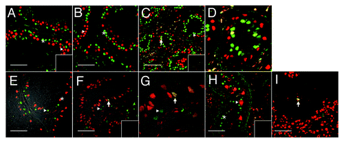 Figure 1. Evidence for Sertoli cell proliferation in men. Confocal immunofluorescence of proliferation markers in testis tissue from normal (A and E) and gonadotropin suppressed men [2 wk, B; 12 wk, C and D (enlarged portion of C) and F and G (enlarged portion of panel F)], in testis with carcinoma in situ (H) and in a tubule adjacent to a seminoma (I). Sections were probed with a combination of either GATA4 (green, in the nuclei of Sertoli cells) within the seminiferous epithelium (asterisks), and PCNA antibodies (red, staining cells with proliferation capacity - triangles) (A–D, H–I), or GATA4 (red) and Ki67 (green, staining proliferating cells) (E–G). Colocalization of GATA4 and PCNA or GATA4 and Ki67 in Sertoli cell nuclei (indicating a proliferative state, arrows) is shown by a yellow color. Figure 1E–G includes a transmitted light channel to illustrate histological detail. Inserts are negative controls. (Bar = 50 µm).