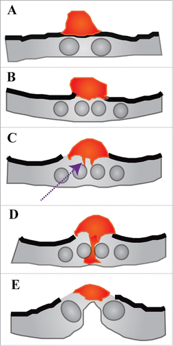 Figure 3. Anchor cell invasion. Schematic anchor cell invasion. Anchor cell shown in red, vulva shown in gray. Basement membrane shown in thick line. Adapted from Ihara et al., 2011 and Hagedorn and Sherwood, 2011. (A) Anchor cell at P6.p two cell stage during mid L3. Basement membrane (shown in thick line) is intact. Anchor cell is dorsal to the P6.p 1° VPC daughters (two circles below). (B) Anchor cell at P6.p four cell stage during mid to late L3. Anchor cell has generated a gap in the basement membrane (see separation between thick lines). Edges of the anchor cell are still in contact with the basement membrane. (C) Anchor cell at P6.p late four-cell stage (late L3). The anchor cell has begun forming protrusions that will invade the vulva (dashed purple arrow). (D) Anchor cell at P6.p late four-cell stage (late L3). The anchor cell has completely invaded the vulva, specifically invading between the 1° VPC granddaughters. (E) Anchor cell at early L4 stage. The 1◦ VPCs have divided and proximal cells are shown. Vulval invagination has occurred and anchor cell will soon fuse with the ρ cells to form the utse.