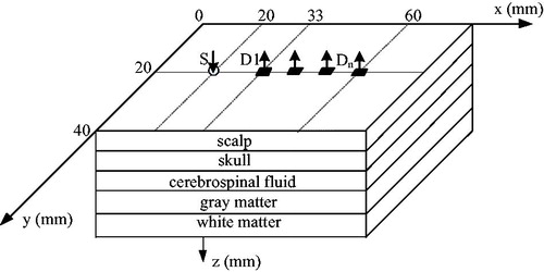 Figure 1. Multi-layered brain structure for Monte Carlo simulations.