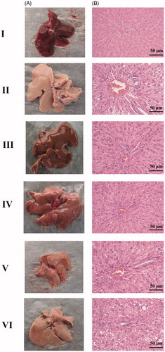 Figure 1. Appearance of the liver (A) and haematoxylin and eosin (H&E) analysis (B). I: control; II: model; III: pioglitazone; IV: high dose of TangGanJian (TGJ: 24.8 g/kg); V: middle dose of TGJ (12.4 g/kg); VI: low dose of TGJ (6.2 g/kg).