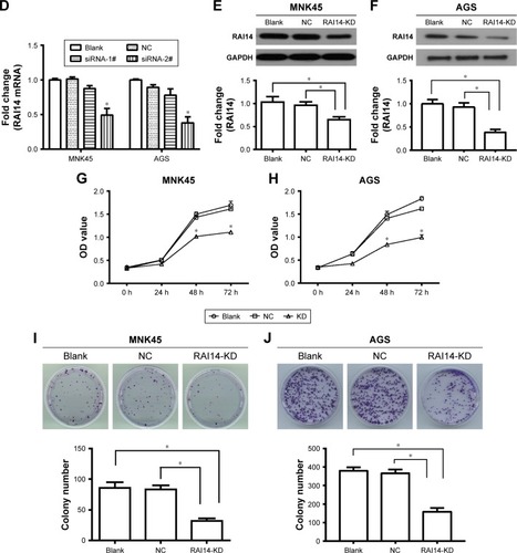 Figure 1 RAI14 downregulation is associated with prognosis of gastric cancer patients and reduces proliferation and viability of gastric cancer cells.