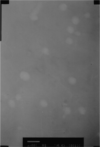 Figure 3 Transmission electron micrograph of 25-OCH3-PPD-loaded self-microemulsifying drug-delivery system.