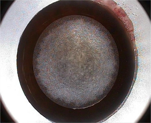 Figure 4 Opaque bubble layer.