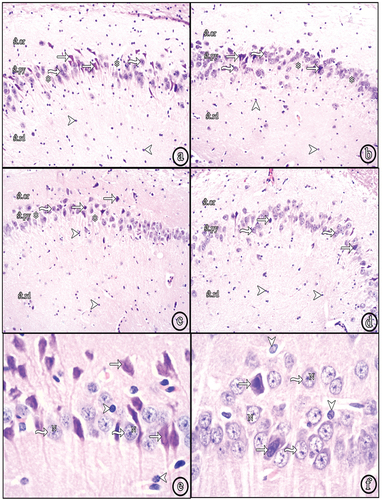 Figure 2. Photomicrographs of paraffin sections in CA3. (a) Group II shows numerous shrunken darkly stained pyramidal and neuroglial cells. (b) Group III and (c) Group IV show decreased shrunken pyramidal and neuroglial cells. (d) Group V reveals very few shrunken pyramidal cells with increased number of normal ones. Also, neuroglial cells decreased in number (H&E, ×100). (e) a higher magnification of the diabetic group (Group II) and (f) a higher magnification of insulin and Cbl-treated group (Group V) (H&E, ×400); (shrunken pyramidal cells (white arrows), normal pyramidal cells (wavy arrows), neuroglial cells (arrow heads), focal areas of cell loss (asterisks), vesicular nuclei (N).