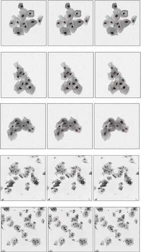 Figure 11. Segmentation results. The left images are the synthetic image and the EDF image, the middle images are the labeled boundary images, and the right images are the nucleus boundary image obtained by the algorithm in this paper