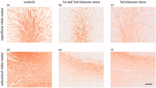 Figure 6. Effects of chronic maternal stress on myelination in white matter of fetal sheep brain at 0.87 gestation. Representative photomicrographs of MBP immunohistochemistry (brown precipitation) of the superficial white matter (a–c) and the subcortical white matter (d–f). Stress during the first and second trimester but not stress during the third trimester reduced MBP IR. Scale bar 200 µm.