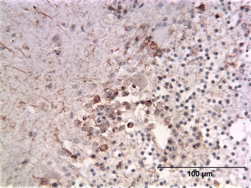 Figure 11.  Immunoperoxidase-stained cerebellum of a blue and gold macaw (Case 0382). This bird was not diagnosed originally as suffering from PDD. The band of cells containing ABV N-protein within the Purkinje cell layer, however, is consistent with that seen in confirmed PDD cases. Arrows point to stained cells.